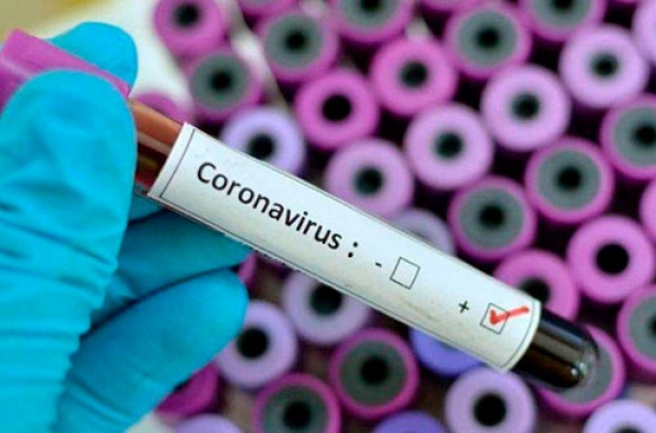 Что известно про инфицированного коронавирусом жителя Черновцов и его семью